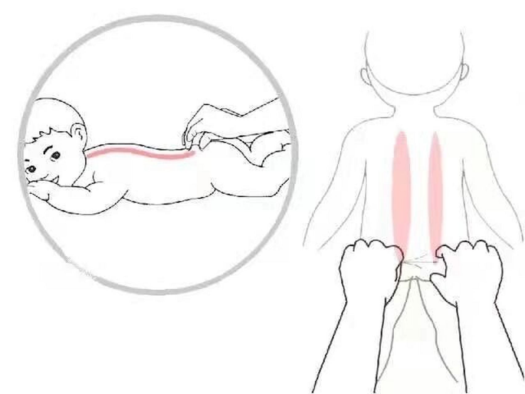 婴儿捏脊椎的好处|如何小儿捏脊 7315婴儿捏脊的好处: 1.