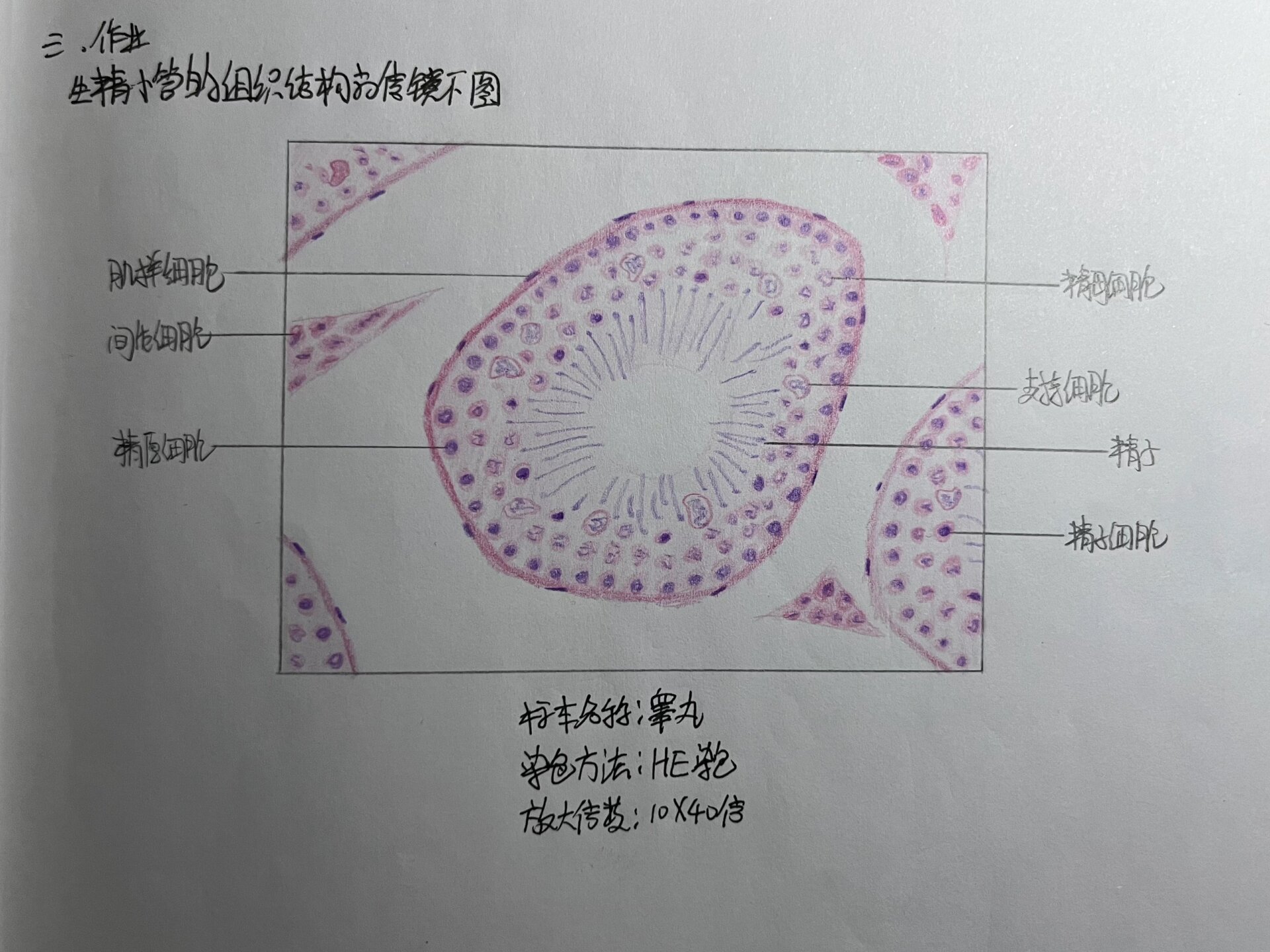 要结课了发一下,比较贴合实际不太算红蓝铅笔( p2 单层立方上皮 p3 中