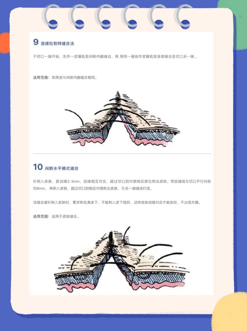 外科13种缝合方法图解图片