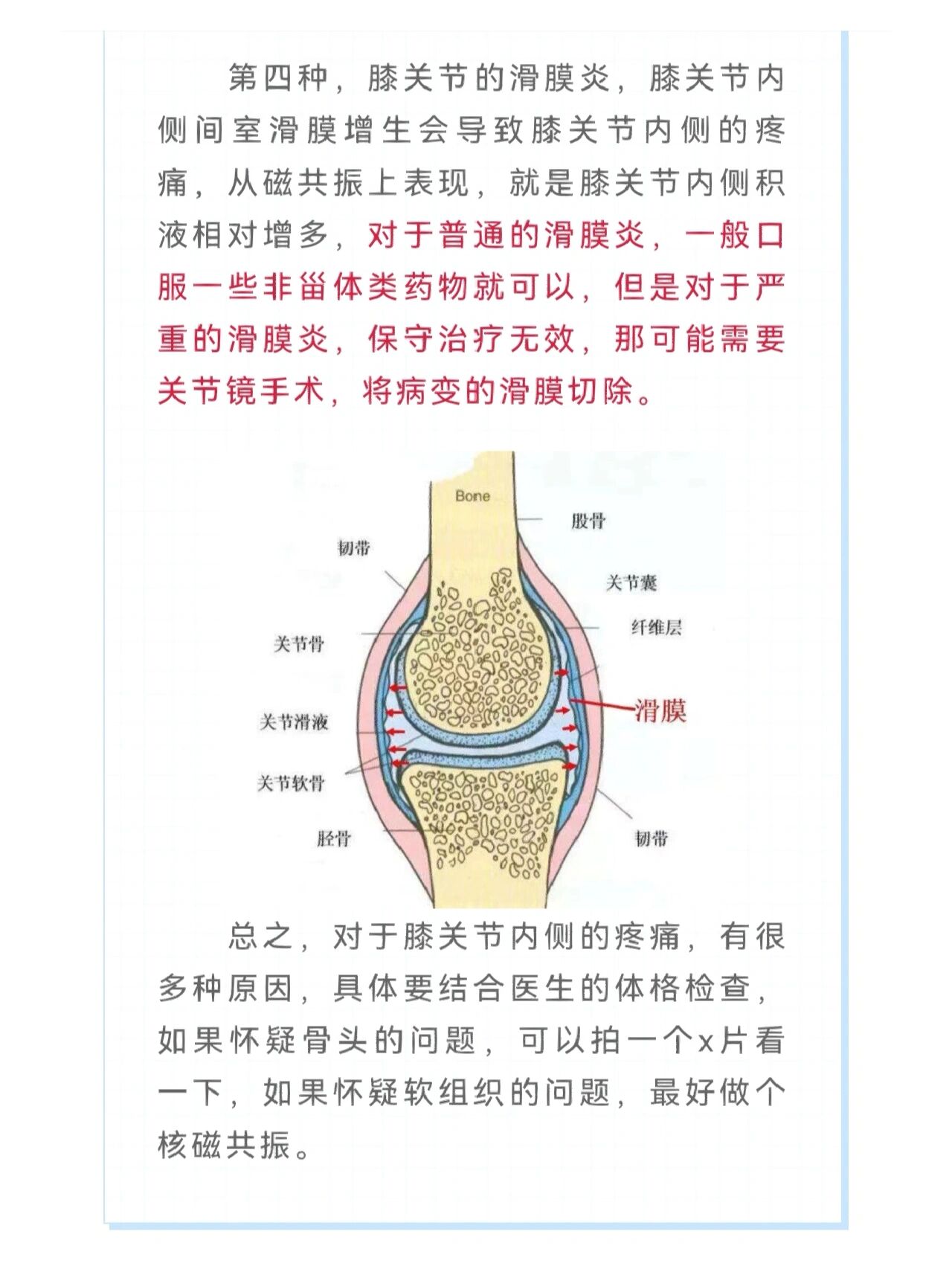 膝盖内侧疼痛图解图片