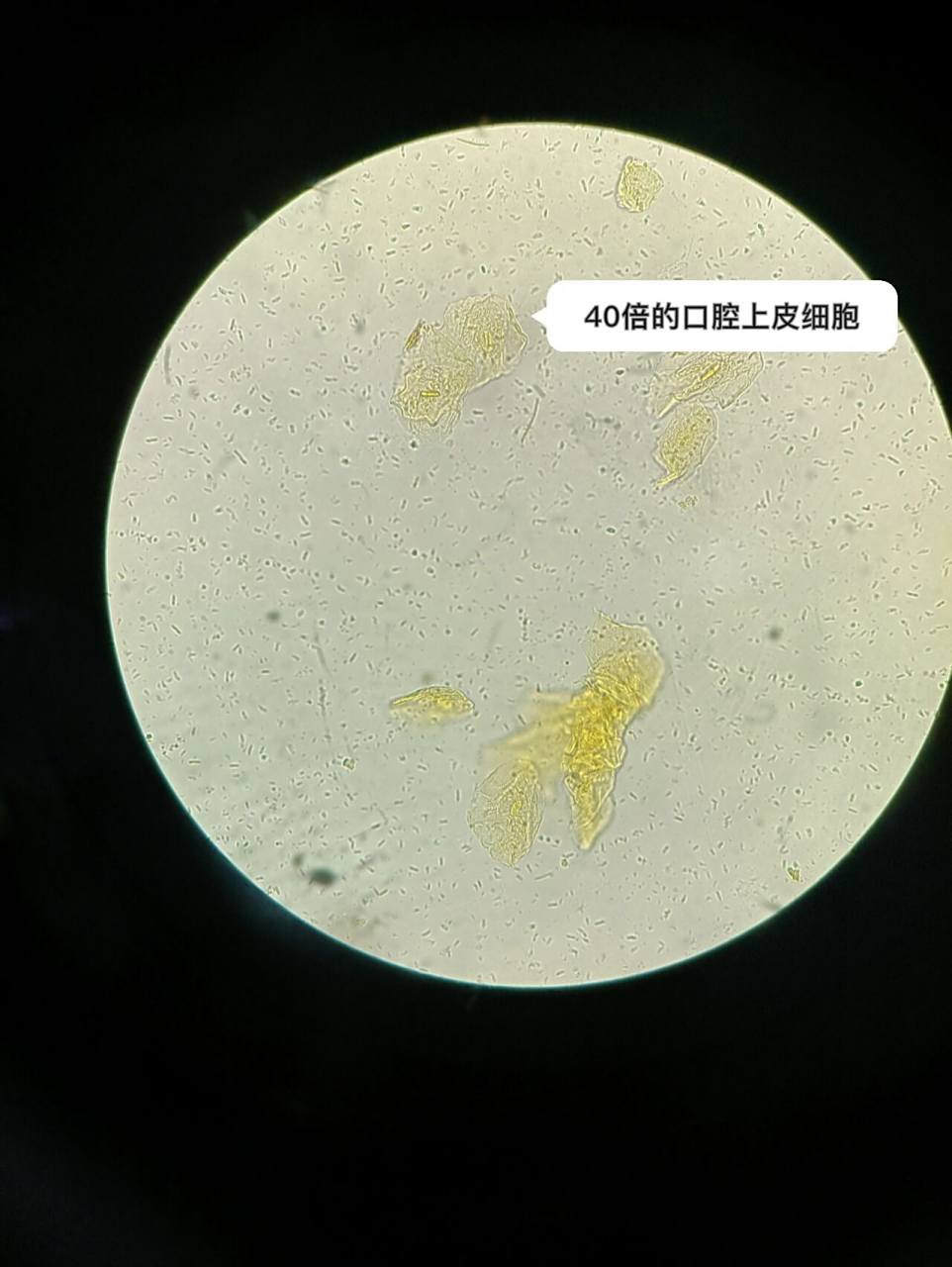 显微镜下的口腔上皮细胞洋葱细胞红细胞