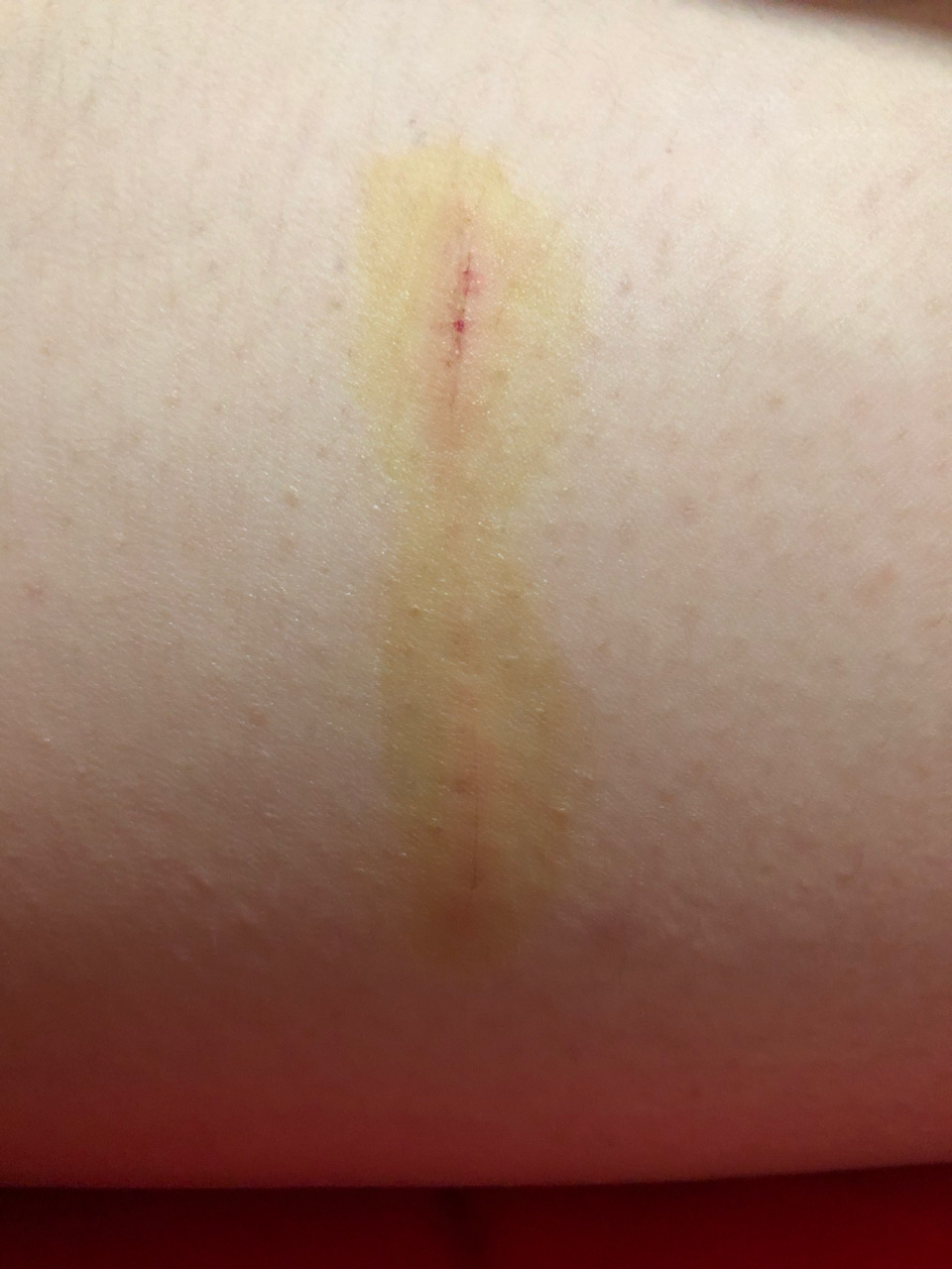 由于3个月没见着我了,我家狗子(金毛)见到我后超级兴奋,就往我身上扑