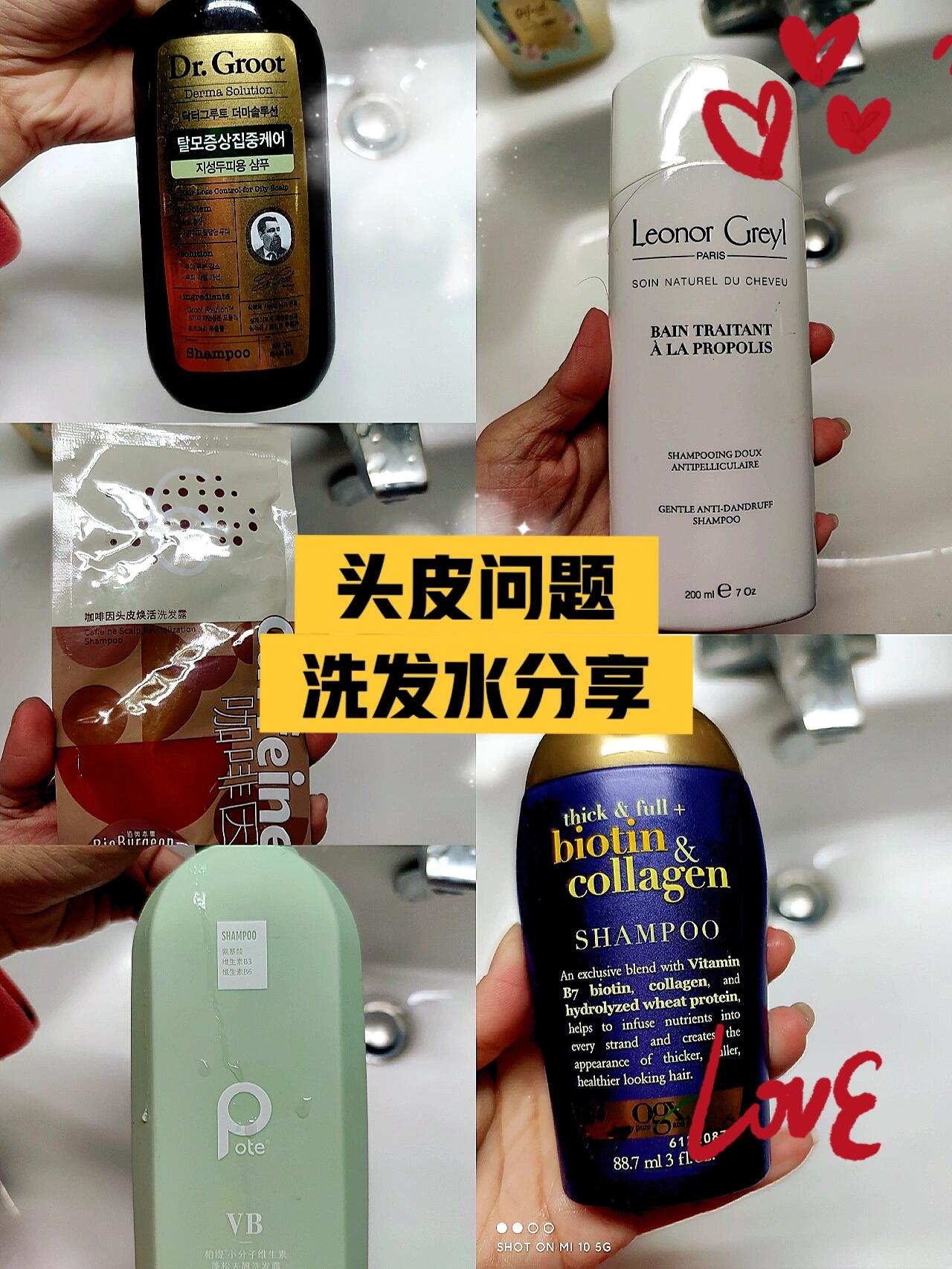 头皮发痒适合的洗发水