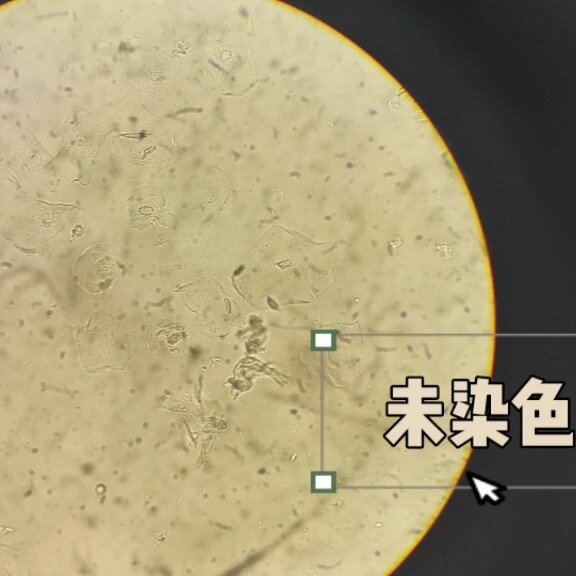 上皮细胞
