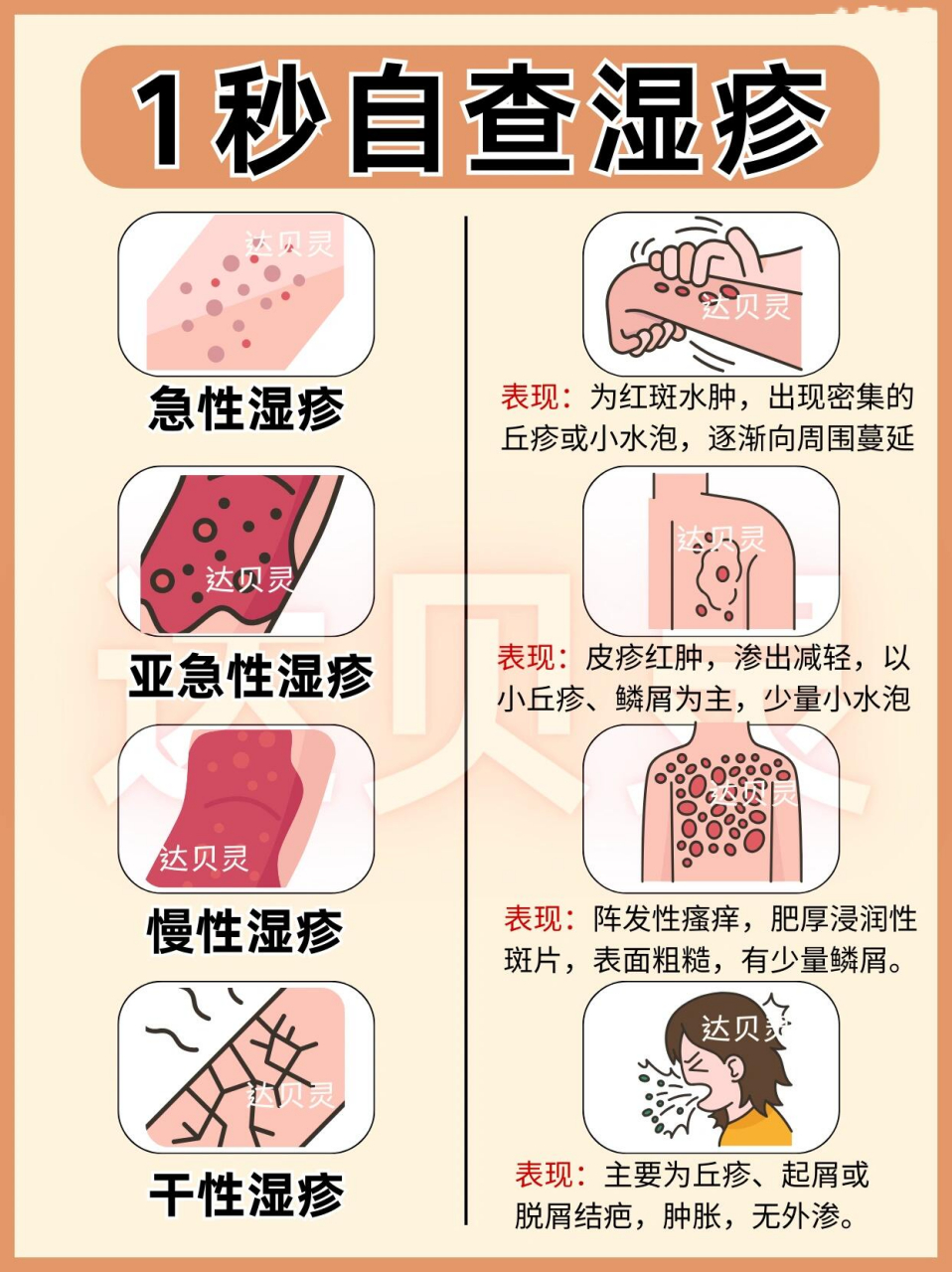 湿疹类型图片