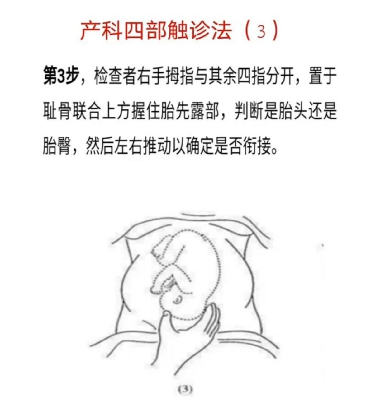 四步触诊法