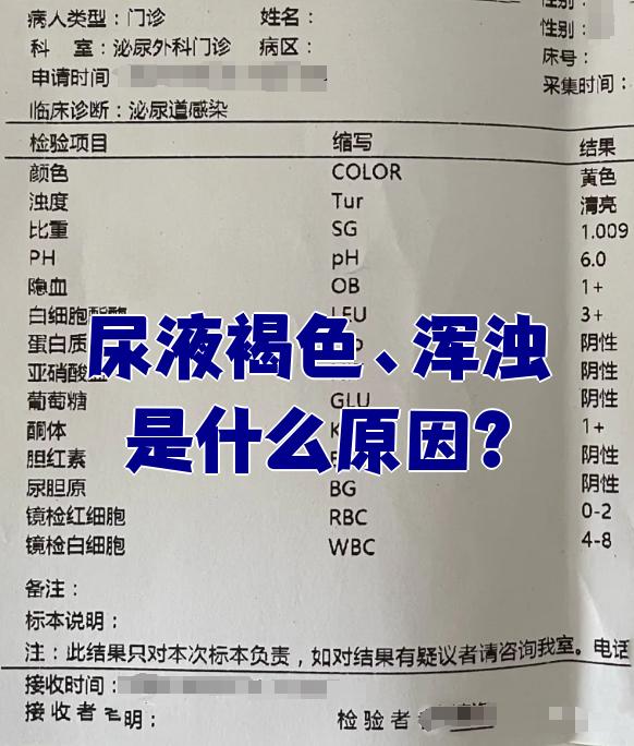 尿液褐色,浑浊是什么原因?