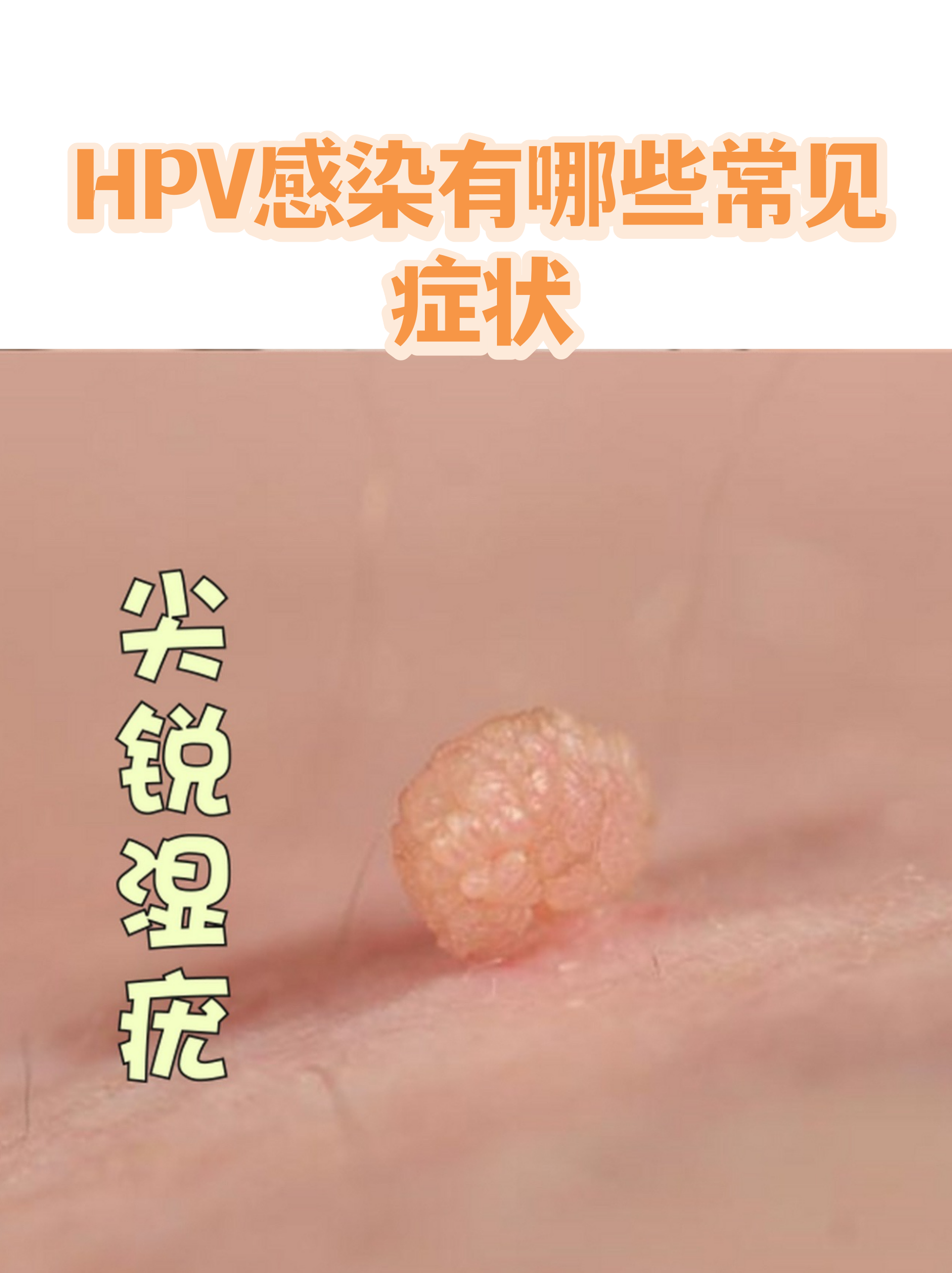  近几年出现的病毒有哪些症状(近期出现的病毒有什么症状表现)