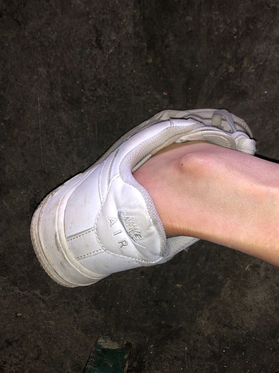 脚踝上有痣真的绝美 照片不是网图 自己拍的