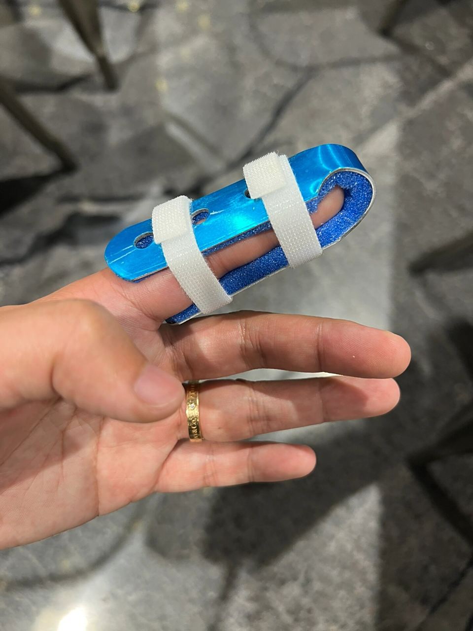 手指脱臼😣😖 昨天打篮球,一次很普通的防守,我伸手去断球,速度太