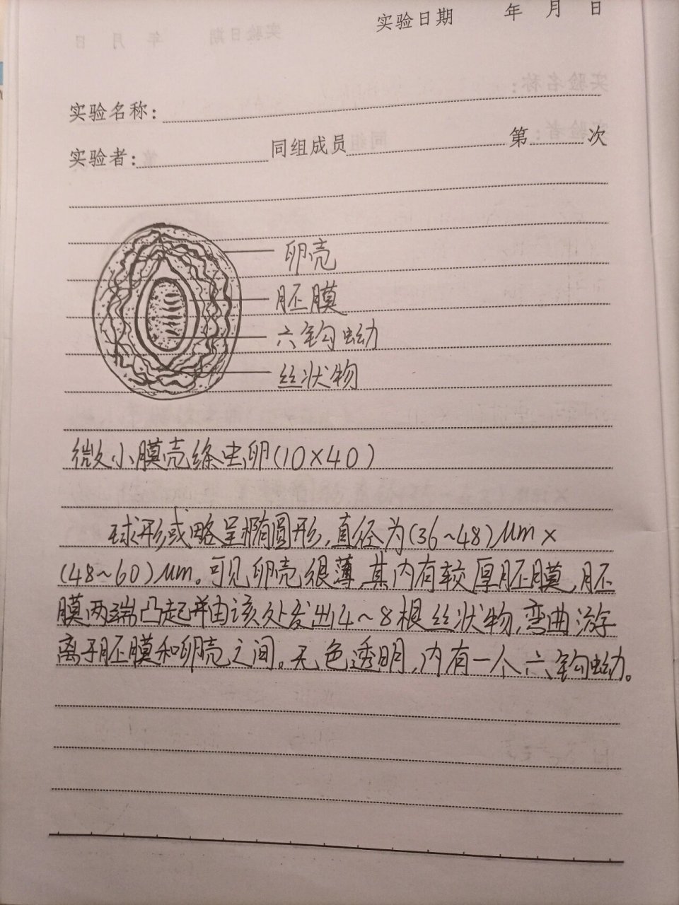 带绦虫卵,微小膜壳绦虫卵