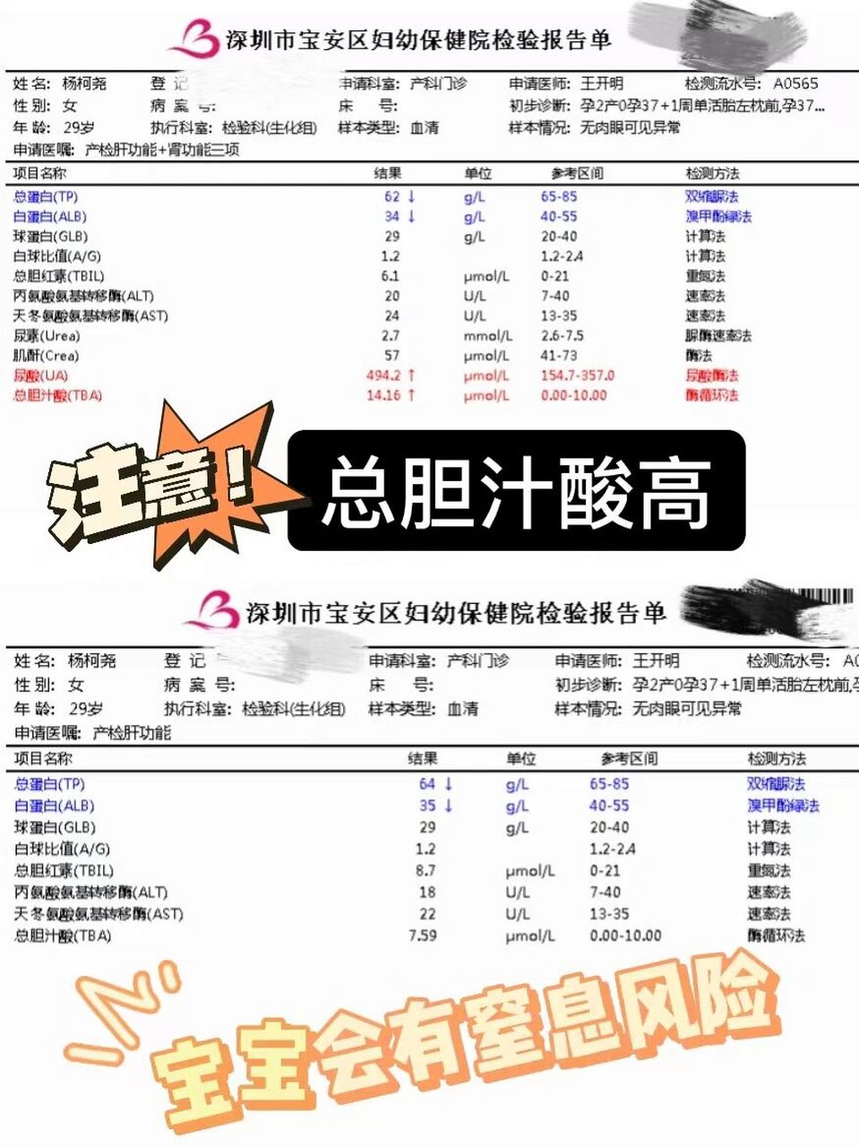 总胆汁酸高! 9999697115医生看了结果,立马就说: "胆