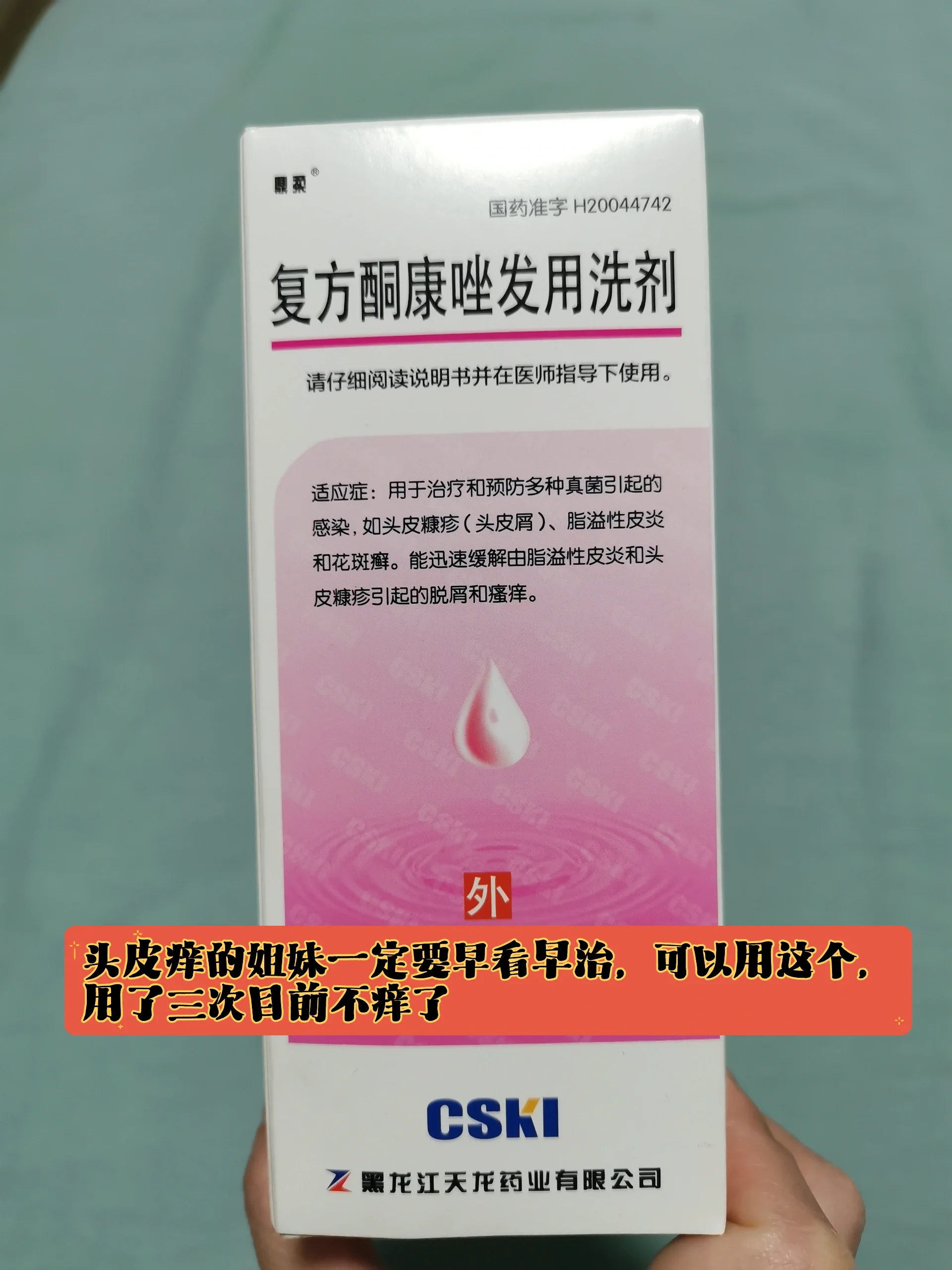 头皮痒,建议用复方酮康唑发用洗剂试试 头皮痒的姐妹一定要早看早治