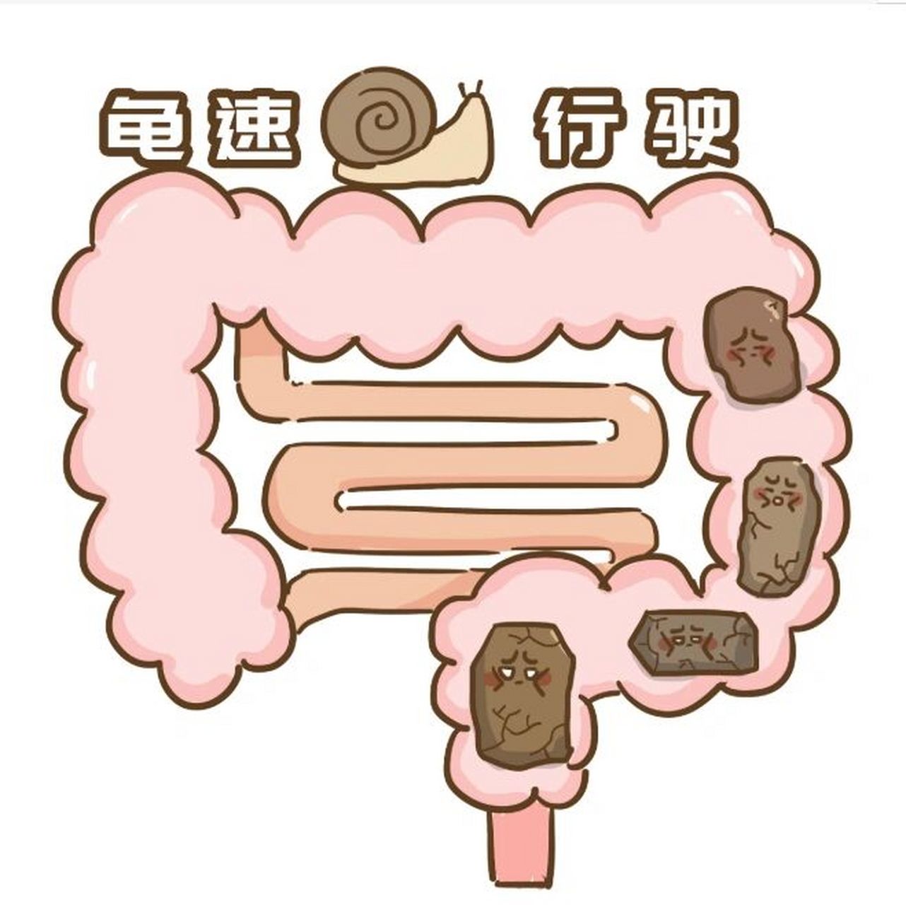 便秘患者,长时间不大便,大便都去哪里了?