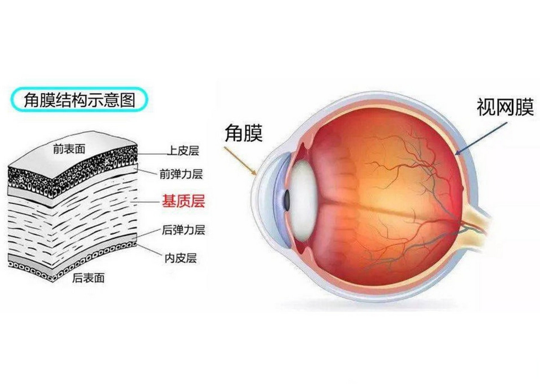 正常人的眼角膜图片图片