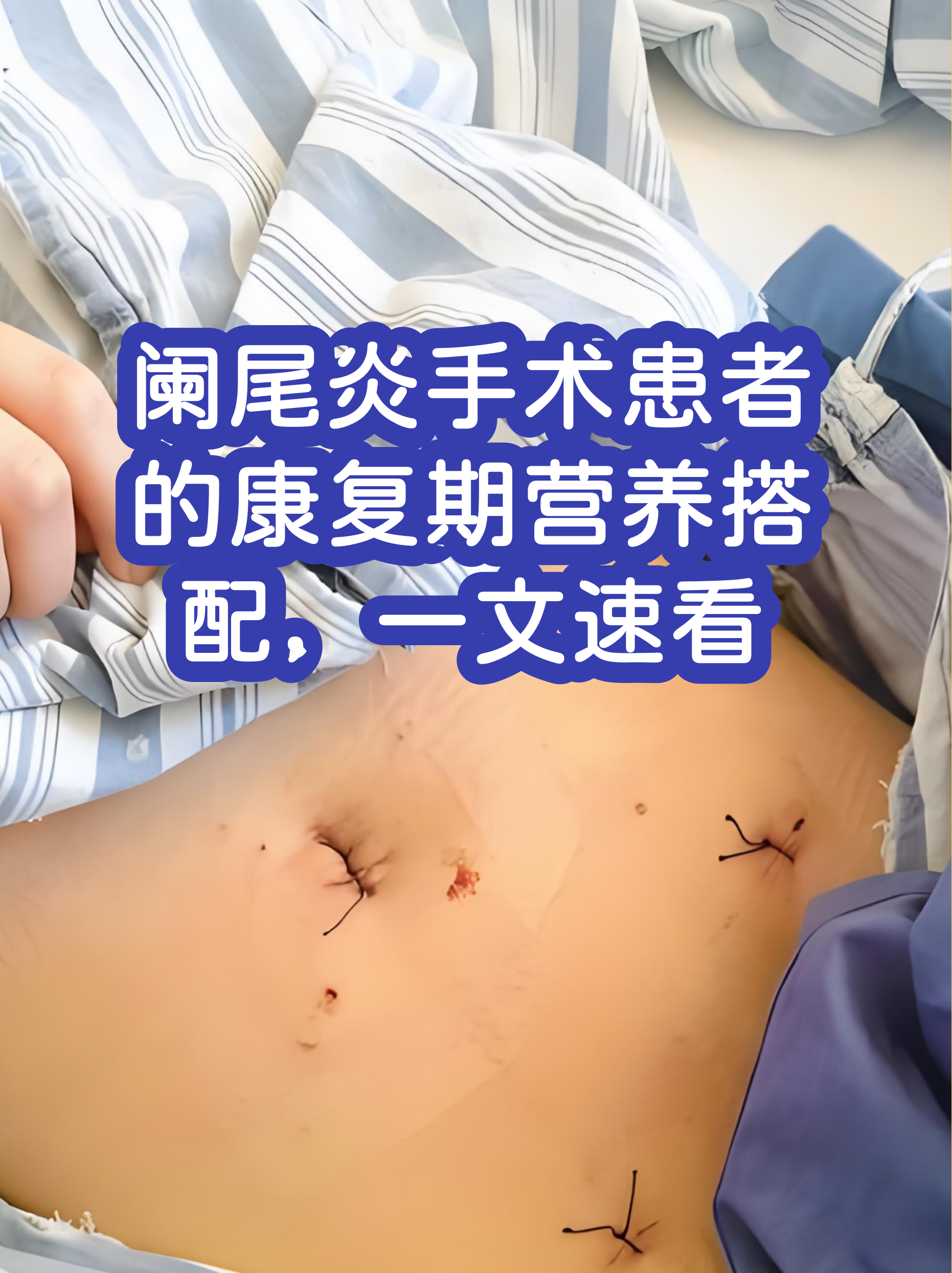 同仁医院检查陪护加挂号术后用药指导提醒，恢复更科学的简单介绍