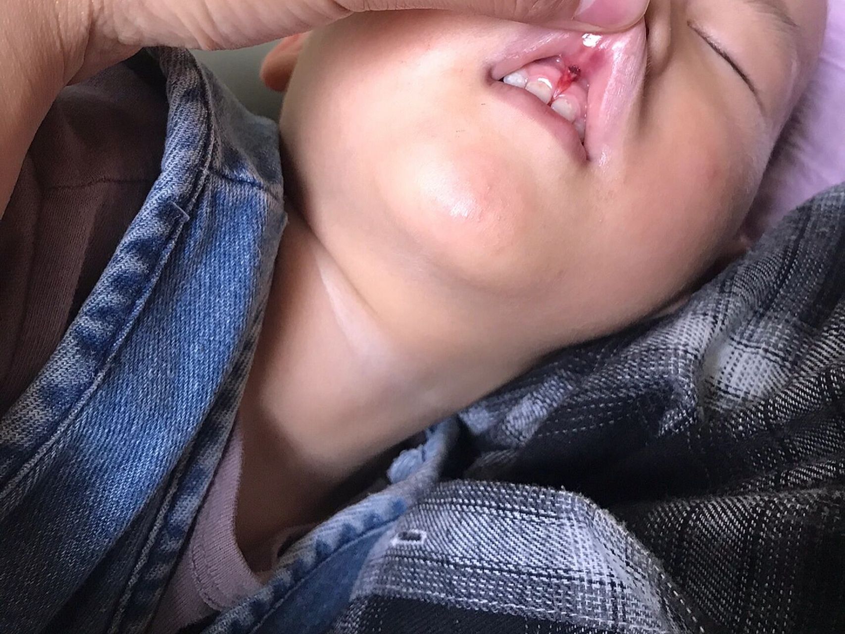 问题 但是当时真的是焦麻了,也算是我的失误,24号晚上宝宝爬高没接住