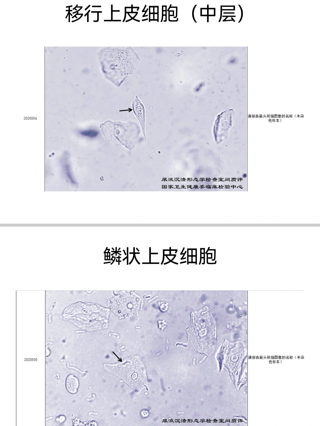 移形上皮图片