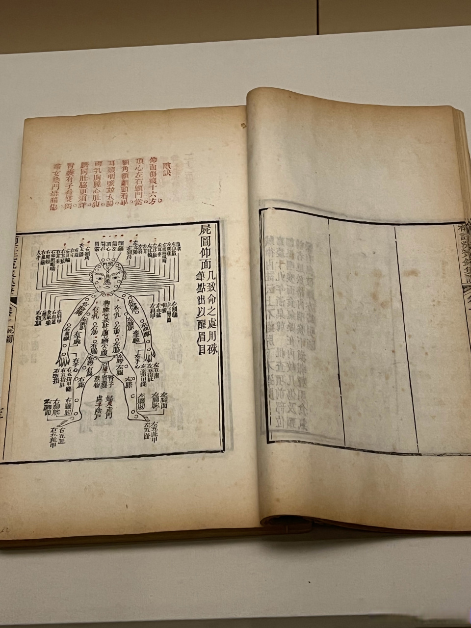 我国的第一部法医学著作《洗冤集录》,比欧洲早300多年