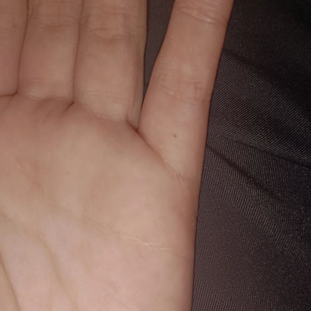 左手小指好像突然长了一颗痣 是怎么回事啊