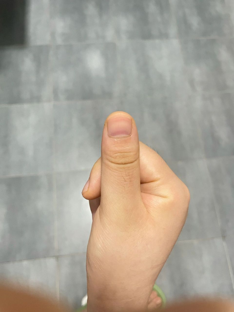 手指甲断层图片