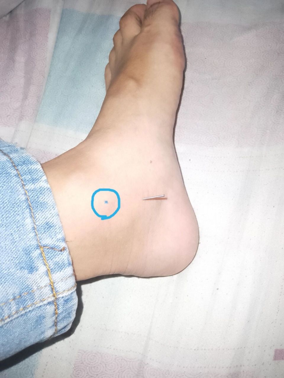 照海的位置与取穴 照海在内踝尖垂直下1.