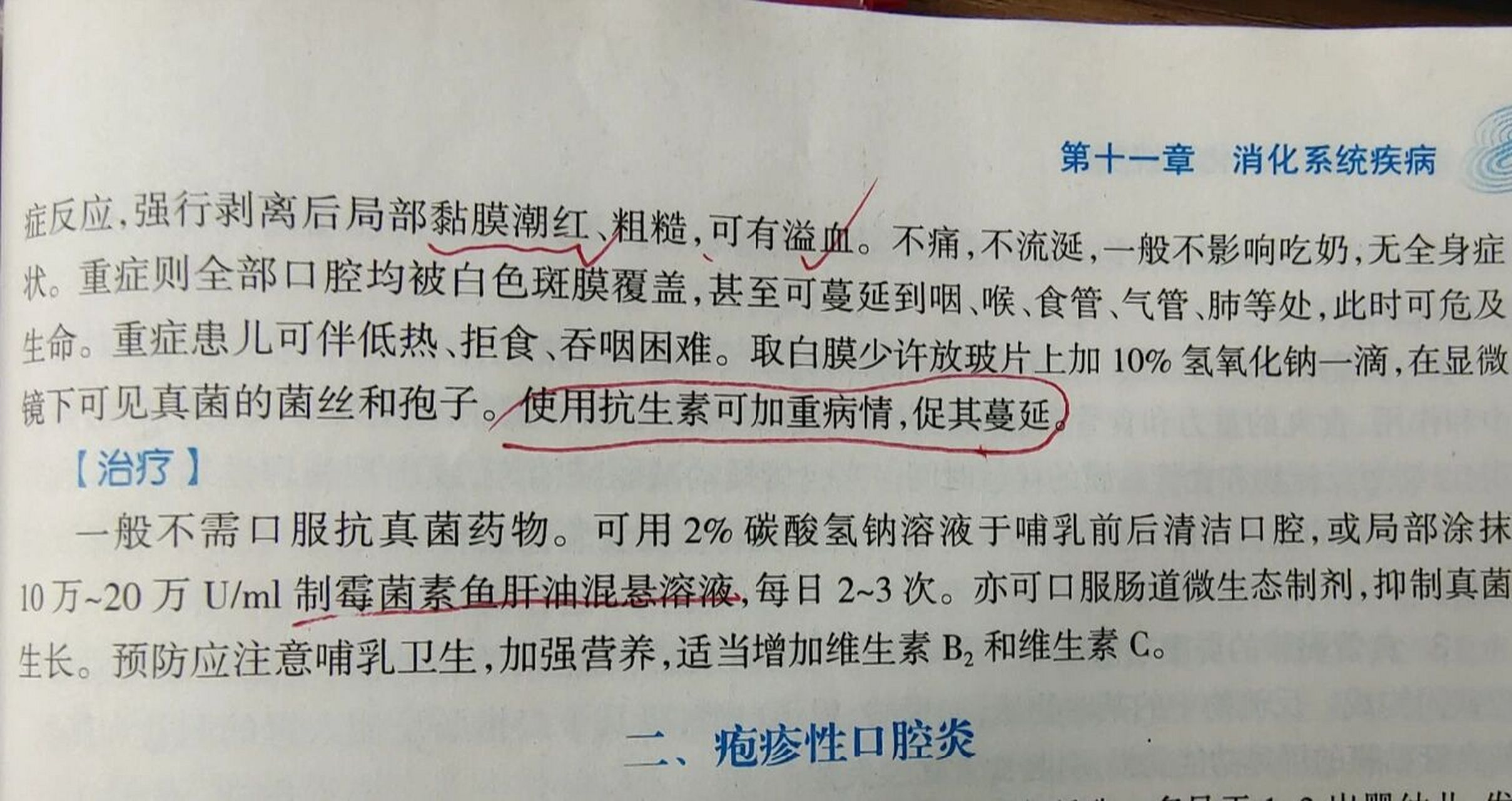 科普:一文讀懂寶寶鵝口瘡 96症狀 鵝口瘡為白色念珠菌在口腔粘膜