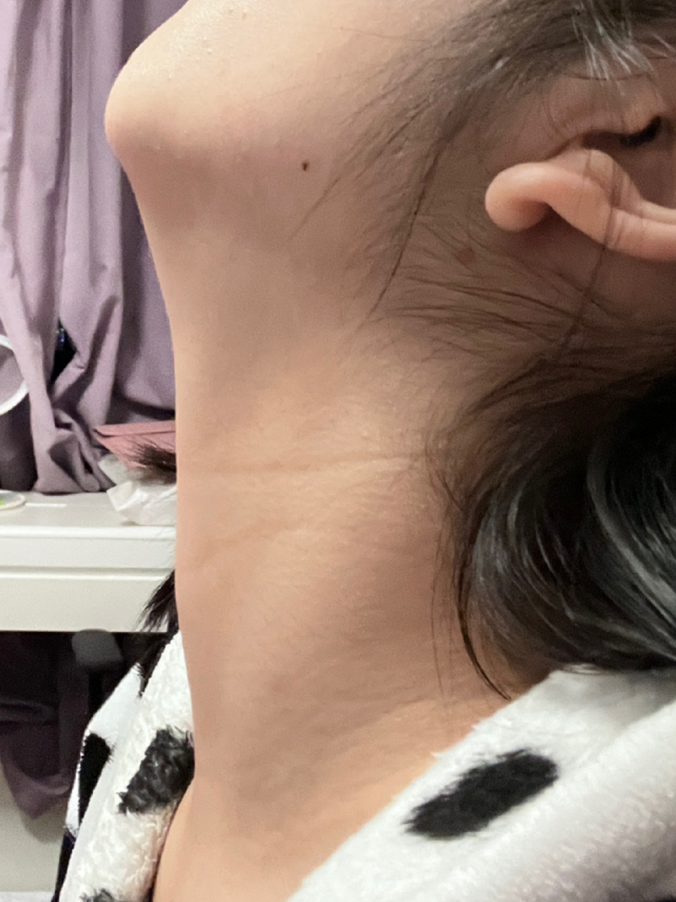 这是甲亢吗? 突然发现脖子有凸起,不会痛,也没啥感觉.这是正常的吗?