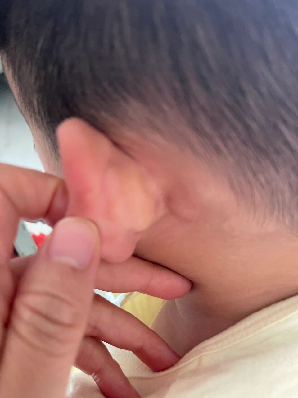 16个月的宝宝耳朵后面长三个小鼓包 有同款宝宝吗?