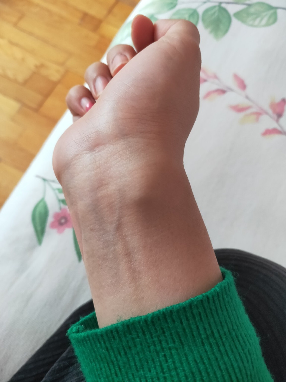 日常生活| 手腕上起个包怎么回事 这个包是怎么回事?