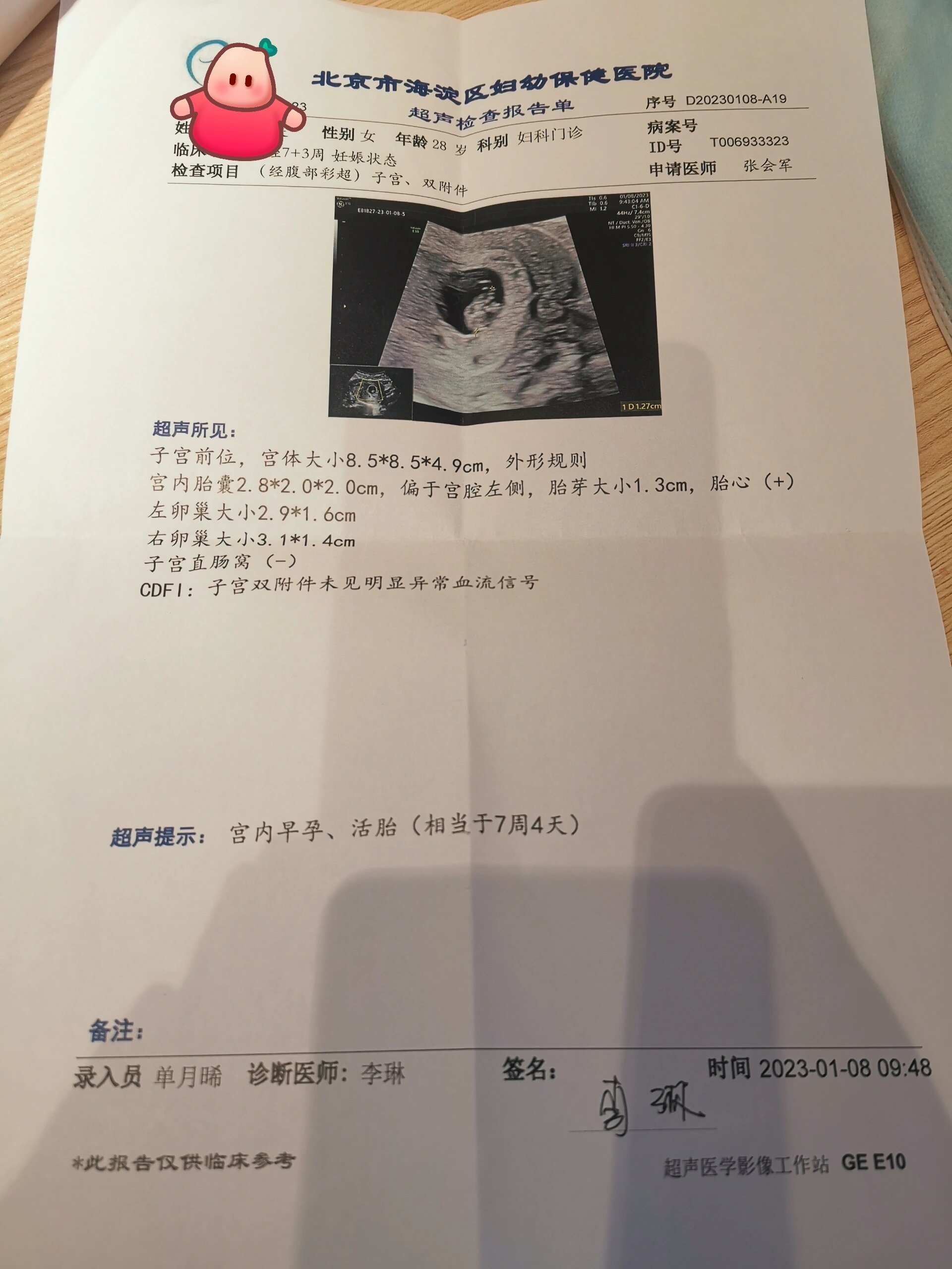 海淀妇幼孕前检查挂号(孕前检查 海淀妇幼保健院)