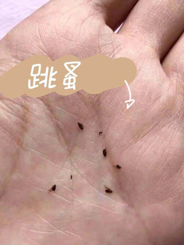 关于床上发现跳蚤这件事!震惊