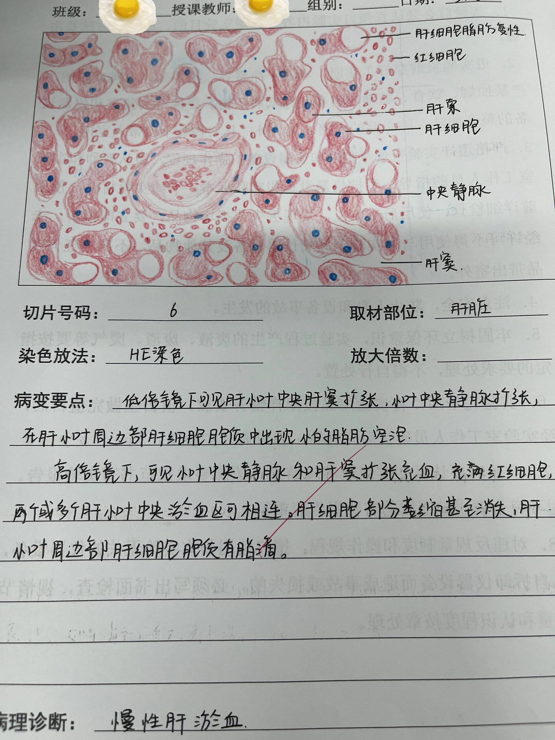 各种炎细胞图片