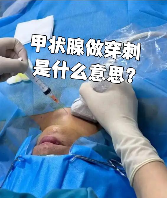 甲状腺穿刺为什么后悔