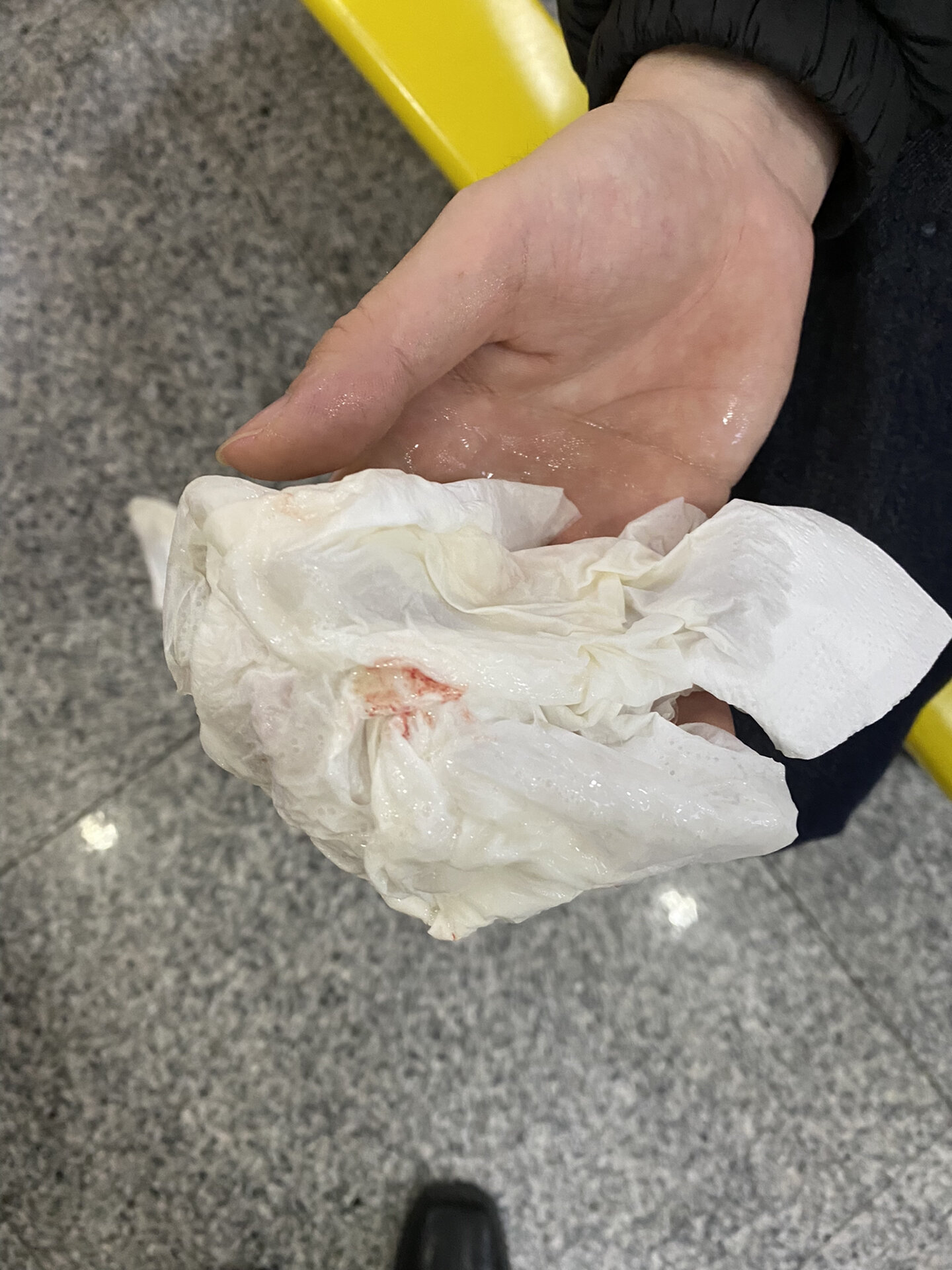 关于宝宝吐奶带血丝