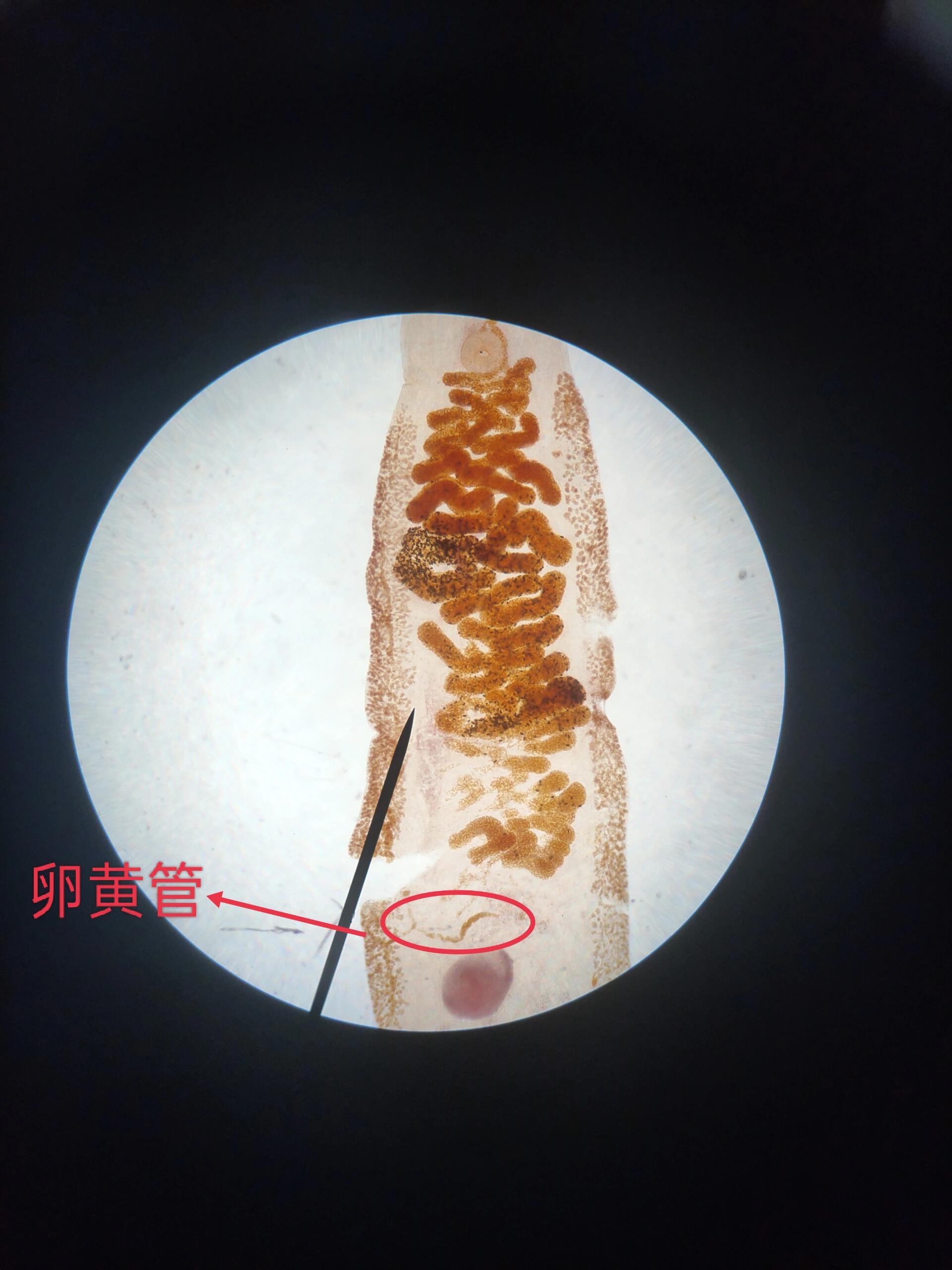 斜管虫显微镜下图片图片