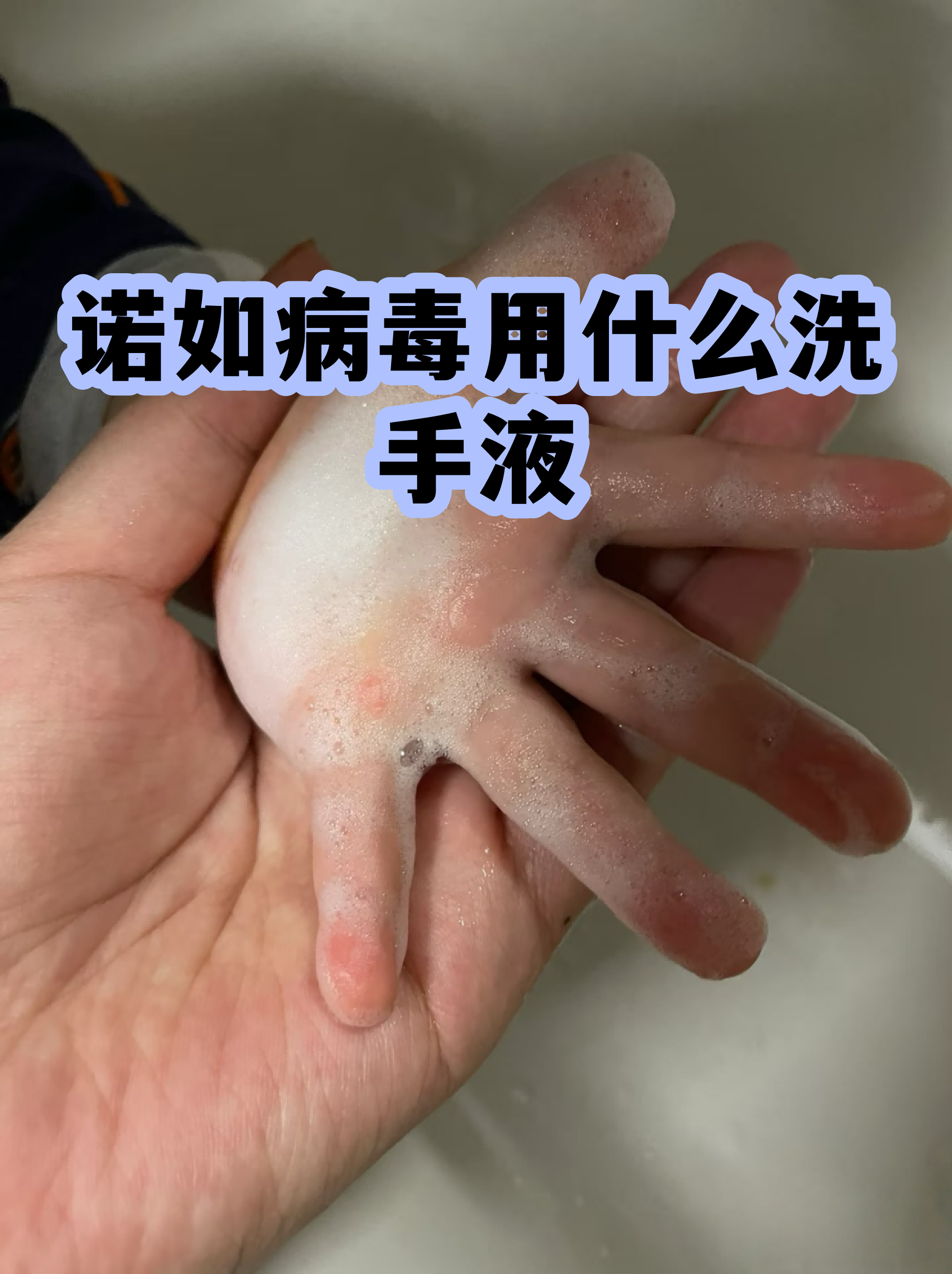  最近是什么病毒又拉又吐(最近又吐又拉的是什么病毒2020年)