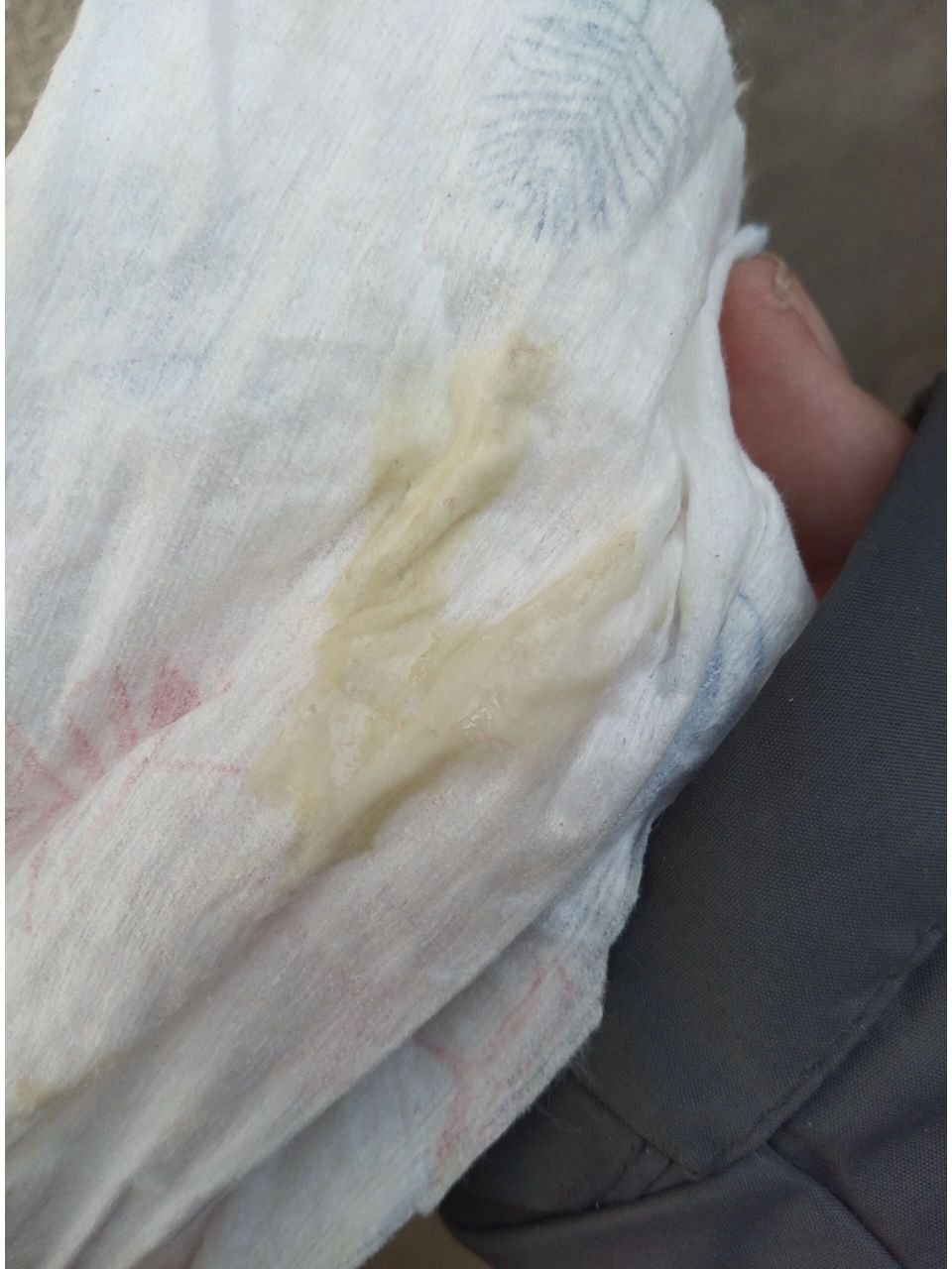 孕晚期 这种分泌物咋回事 这图片不知道能不能发