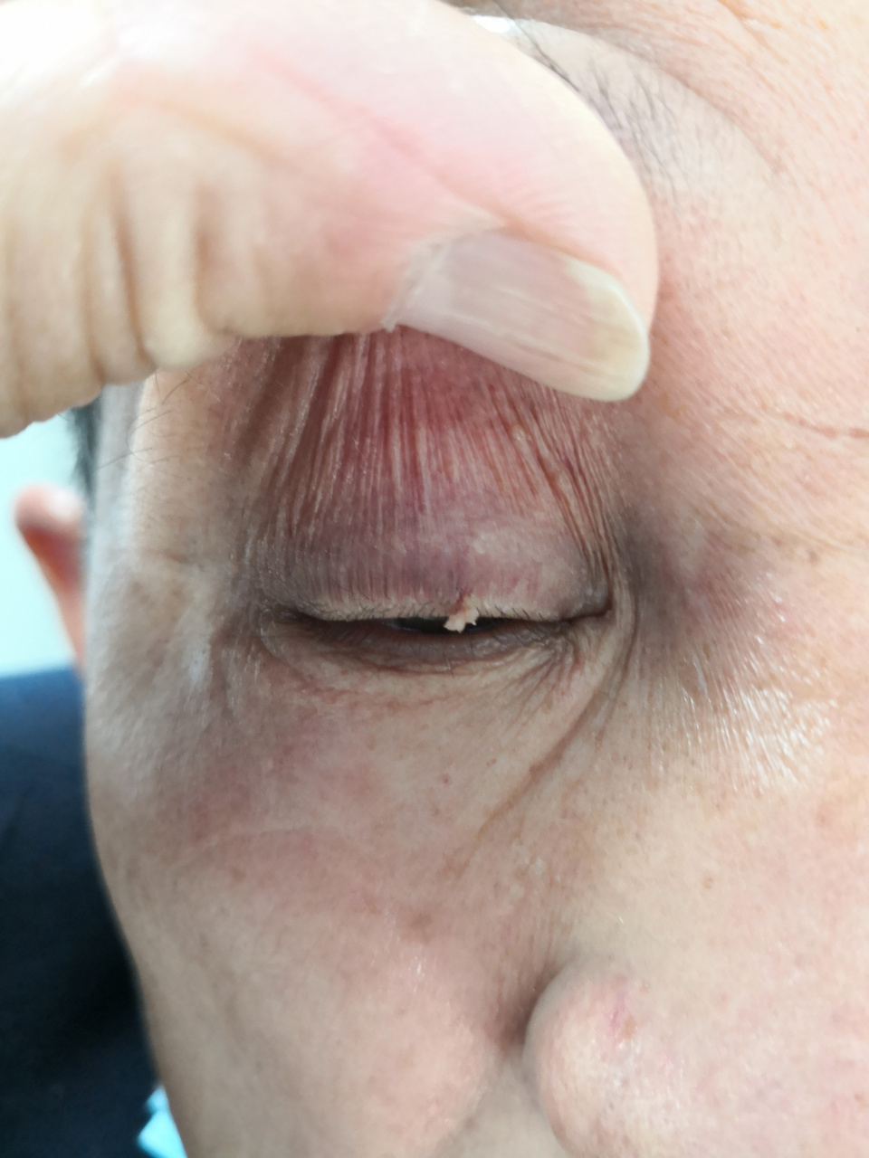 解决皮肤问题专注皮肤美容##皮肤