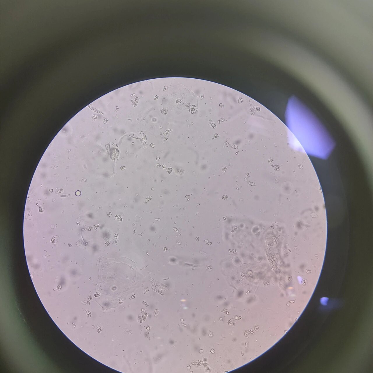 孢子菌镜检图片图片