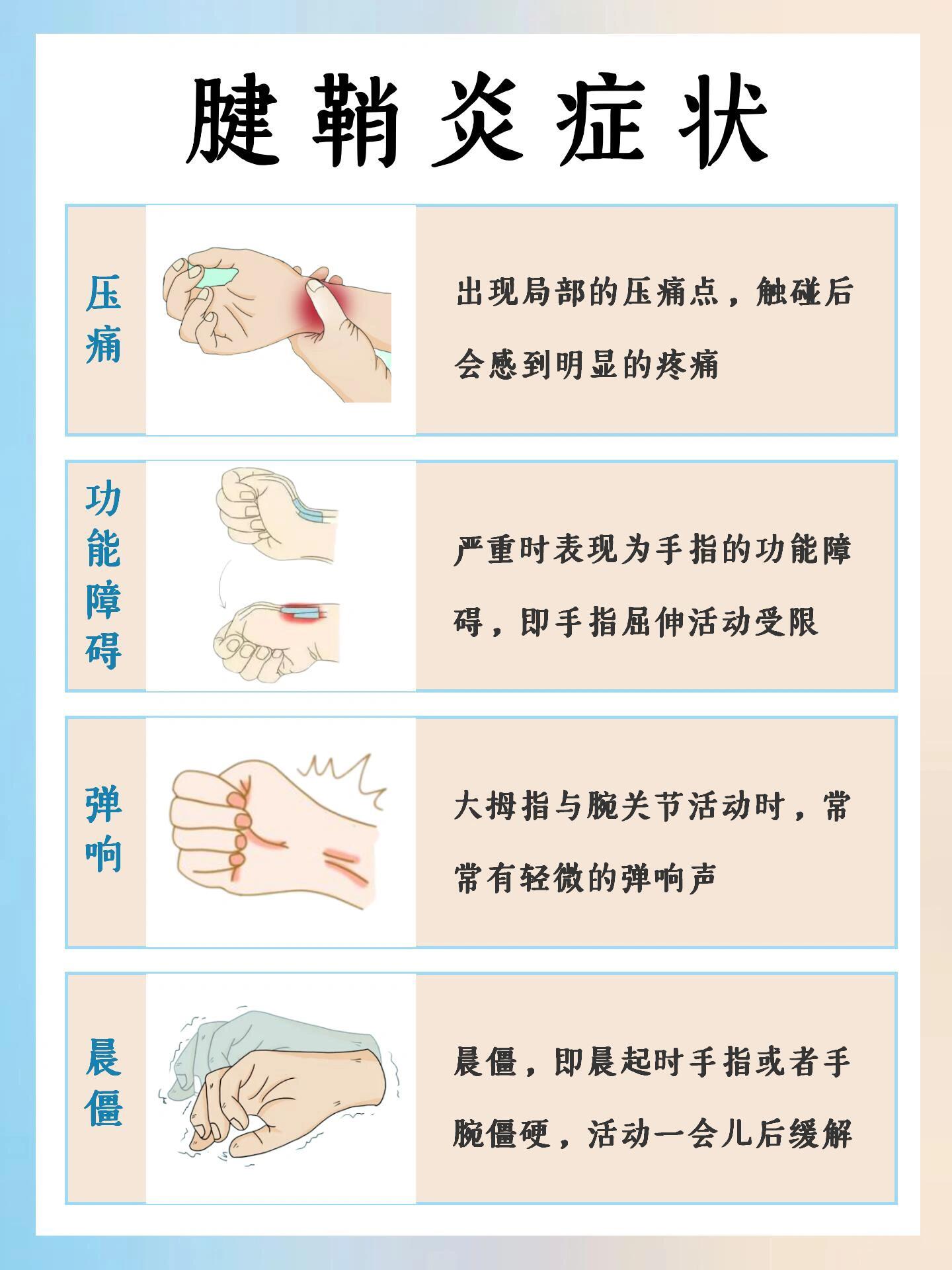 看你有没有腱鞘炎,腱鞘炎怎么预防和缓解 症状 1.压痛 2.功能障碍 3.