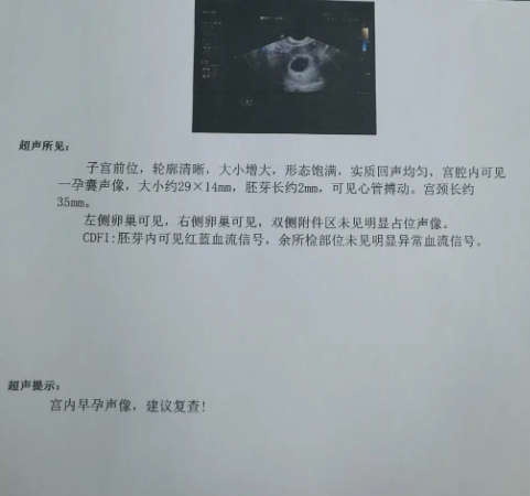 怀孕2周吃药是不能流产的