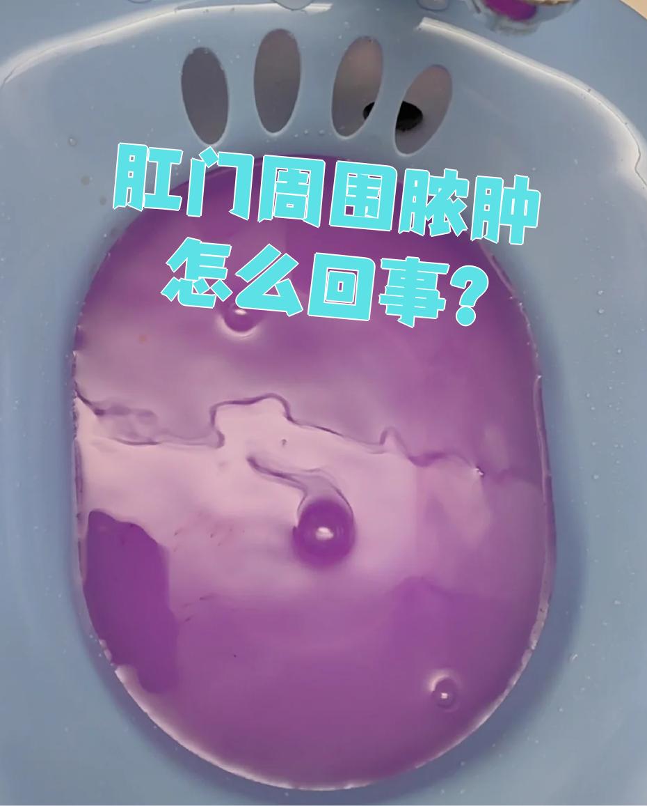 肛门周围脓肿怎么回事?