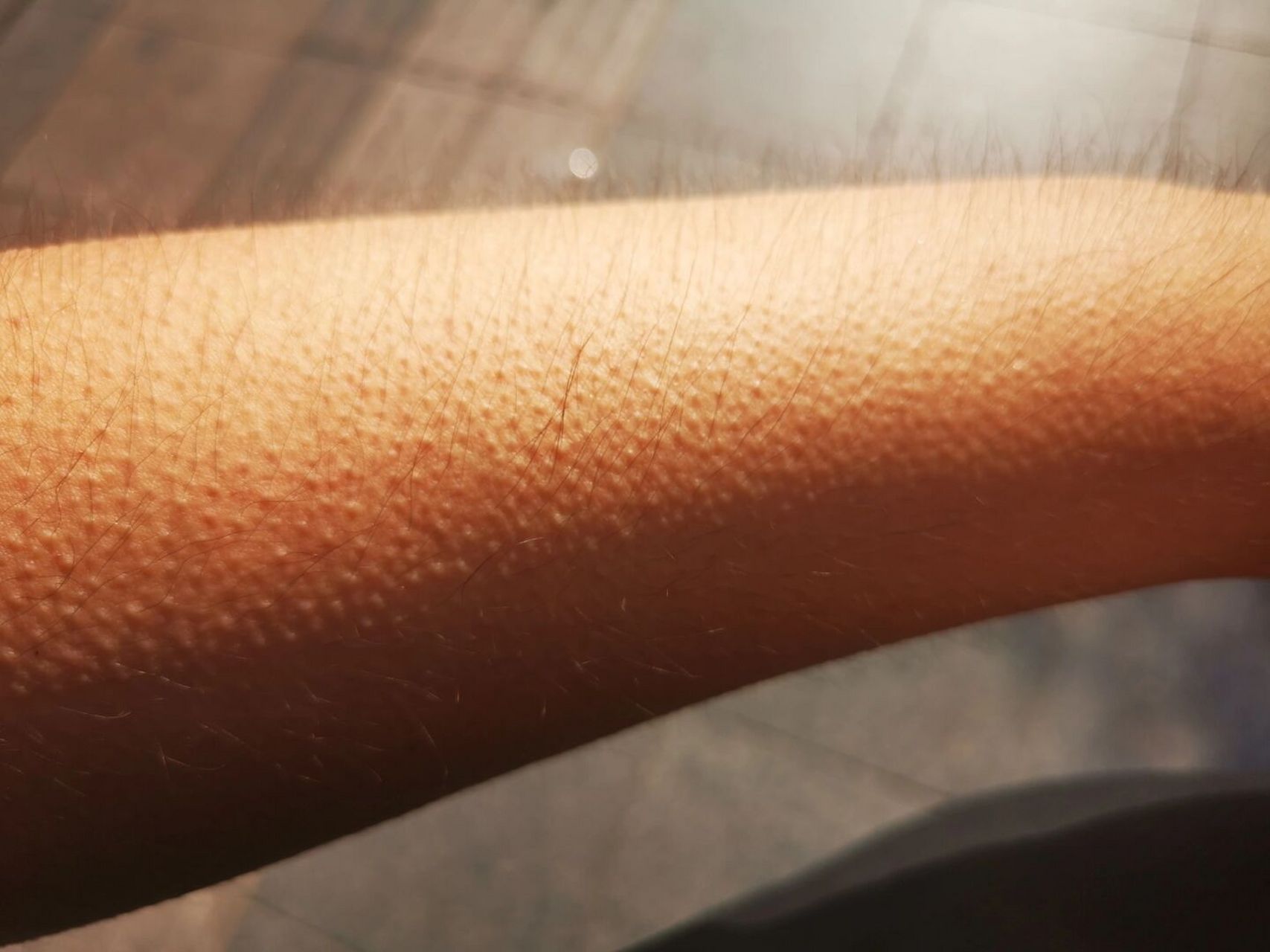 青岛太热了 热的我起鸡皮疙瘩 汗毛炸起 #青岛