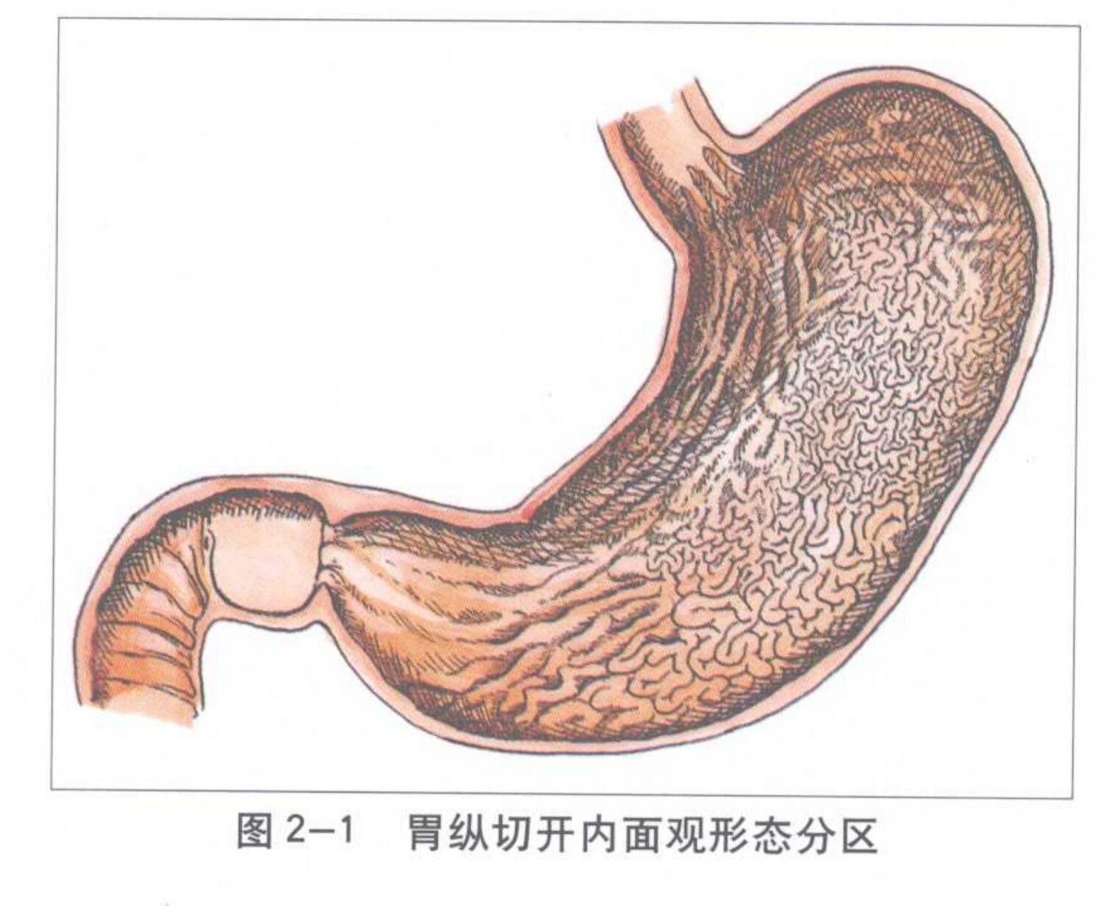 胃的形状有几种图片图片