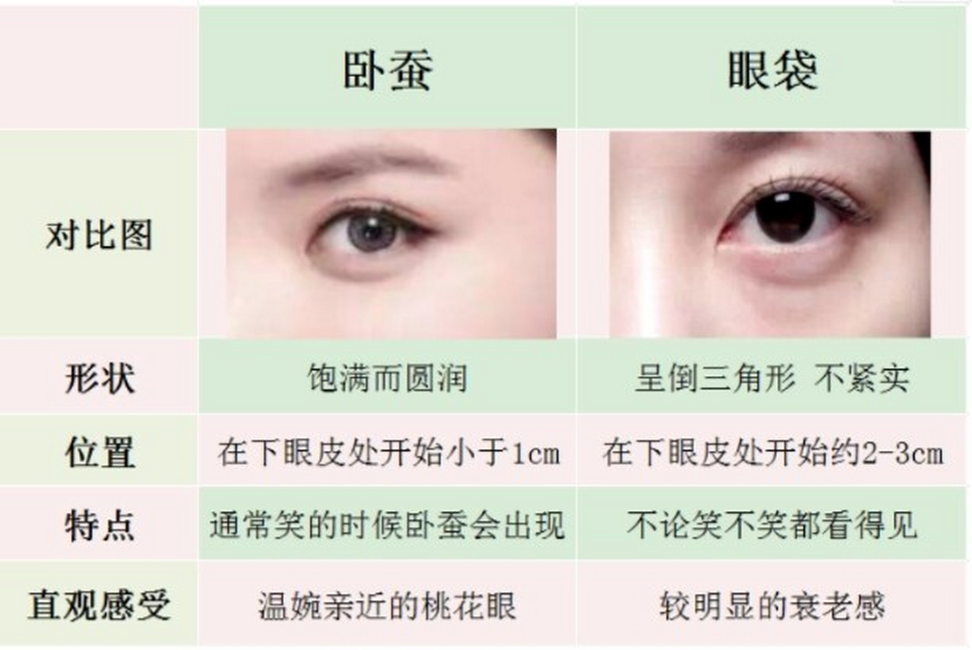 一张图教你区分眼袋与卧蚕 眼睛是当之无愧的"心灵
