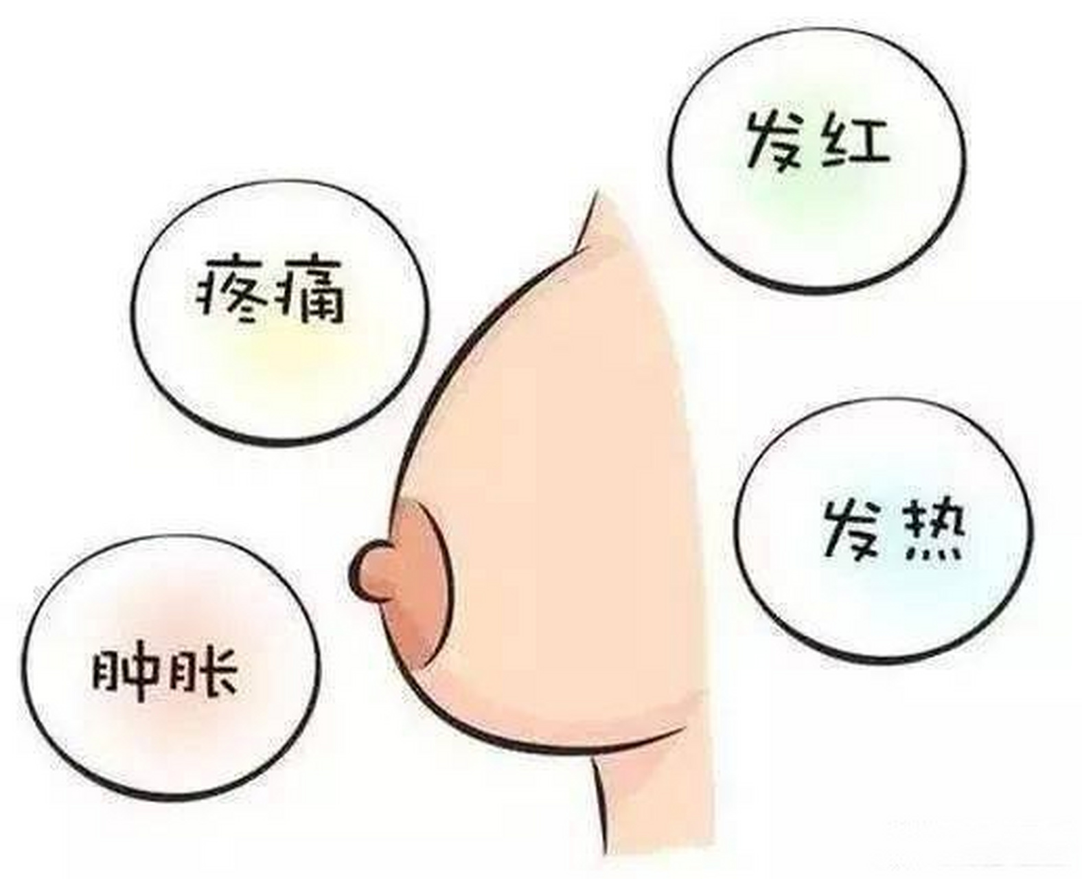 乳头里面痒图片