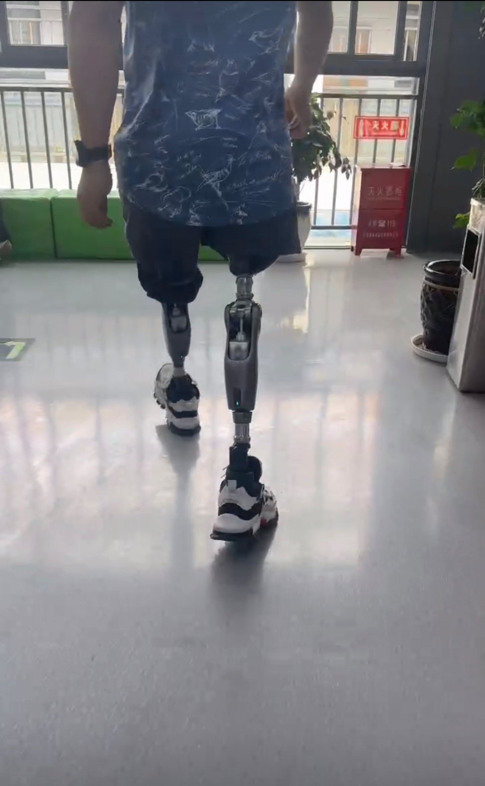 我之前发过一些人工智能假手的内容,也收到很多手指,大腿缺失的残疾人