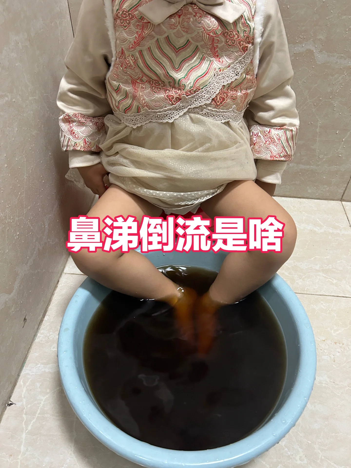 孩子鼻炎鼻涕倒流咳嗽❓泡脚真的屡试不爽 🤷‍♀️白天啥都