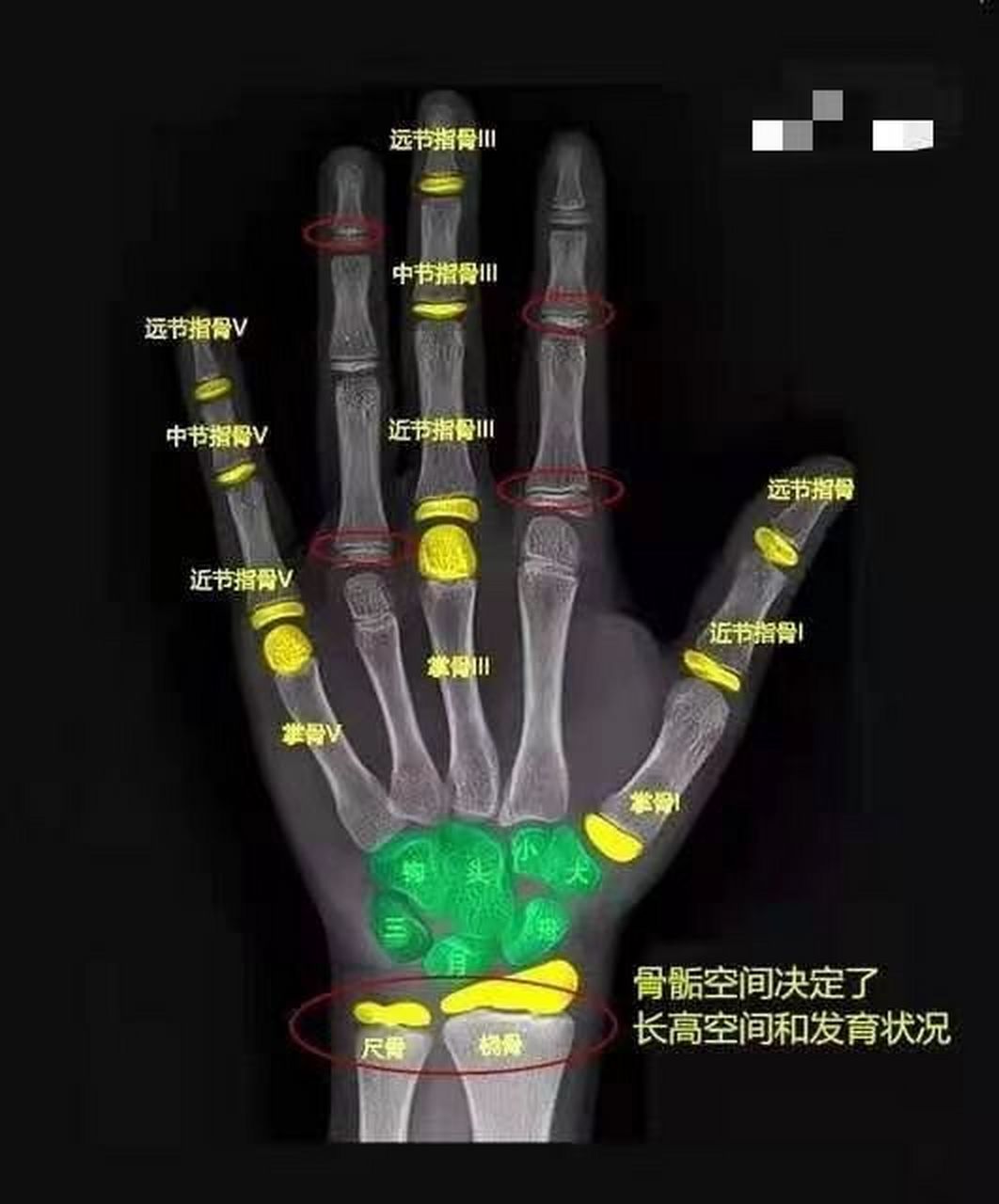 tw3和中华05看的方法不同,tw3是看图中绿色的腕骨,中华05是看图中